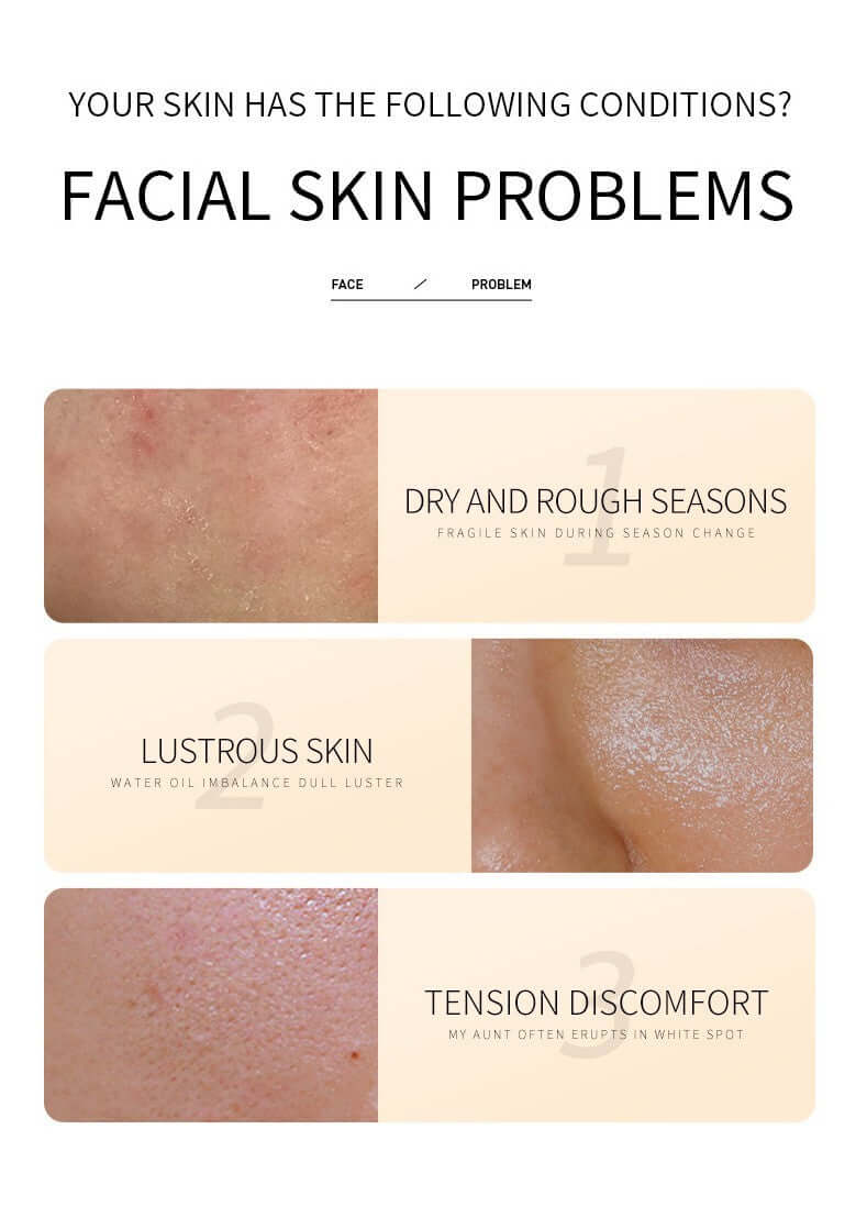 Facial skin problems infographic displaying dry skin, lustrous skin, and tension discomfort conditions.