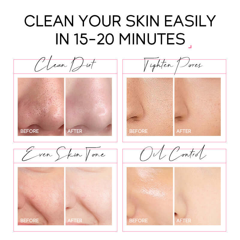 Before-and-after images showing pore cleansing, dirt removal, and skin tone improvement in 15-20 minutes with a face mask.
