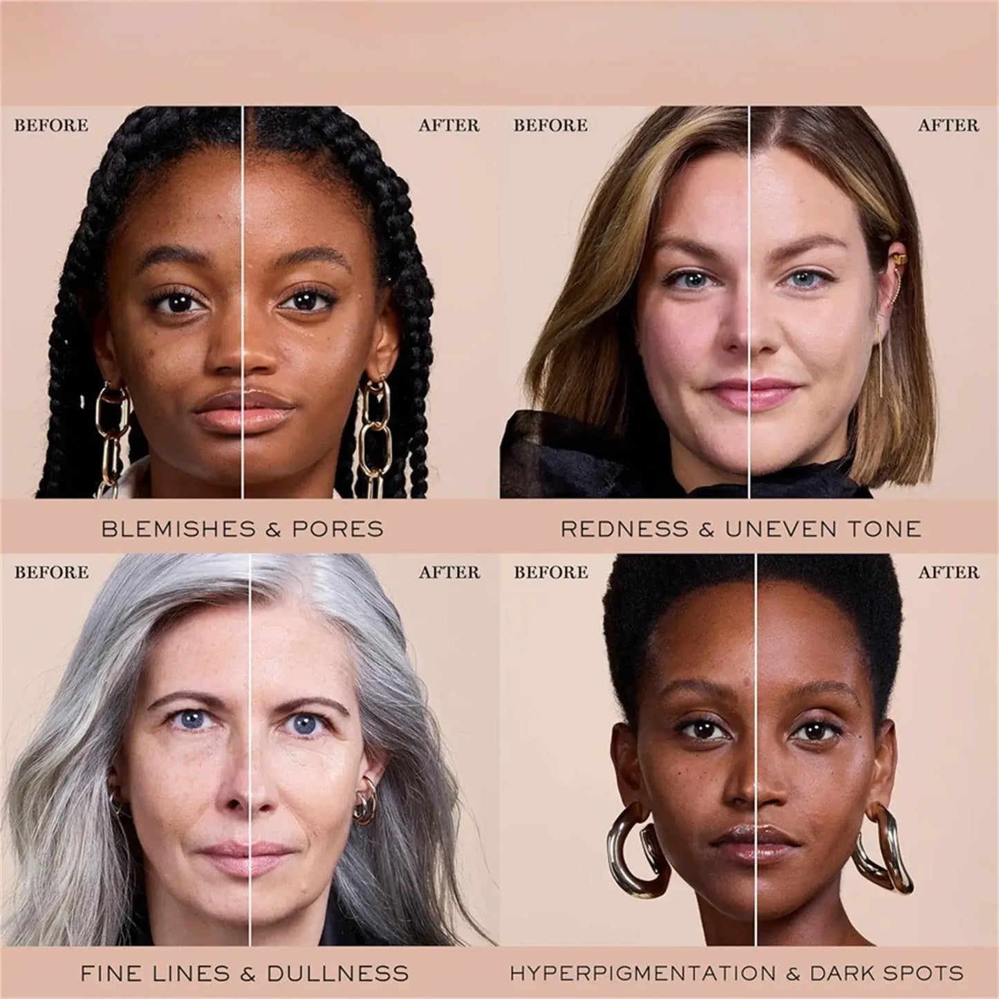 Before and after skin improvement showcasing blemishes, redness, dullness, and hyperpigmentation treatments.